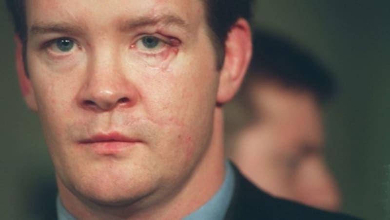 Trevor Rees-Jones kurz nach seiner Entlassung aus dem Spital 1998 (Bild: AFP)