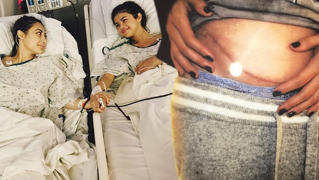 US-Popsängerin Selena Gomez bekam eine Niere von ihrer besten Freundin. (Bild: instagram.com, krone.at-Grafik)