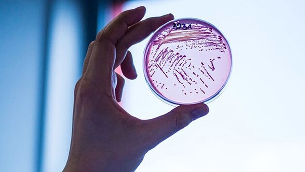 Ein Abstrich der multiresistenten E.-coli-Bakterien