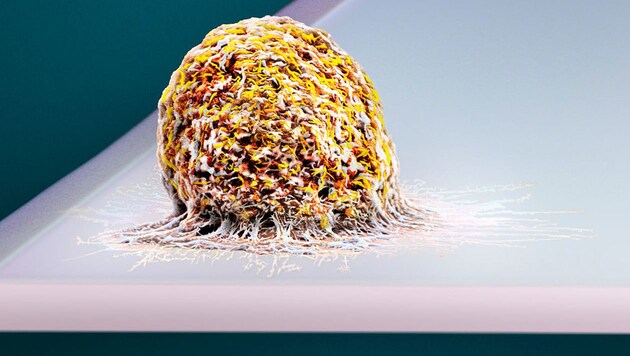Eine Zelle auf dem Ende des schwingfähigen Federbalkens der Waage (Bild: Micronaut.ch/ETH Zürich/Uni Basel)