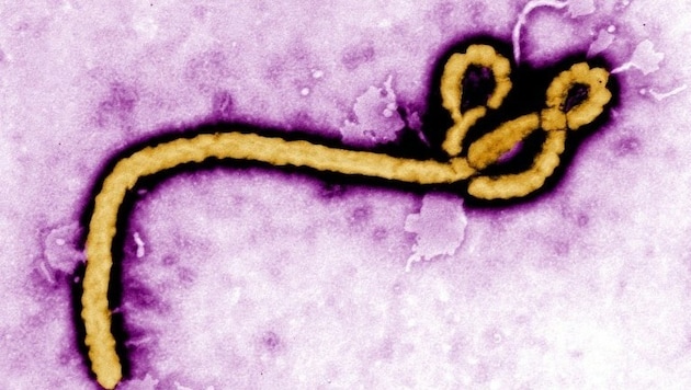 Kolorierte elektronenmikroskopische Aufnahme des gefährlichen Ebolavirus (Bild: CDC)