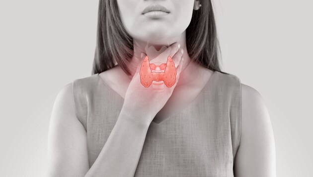 Thyroid nodules are benign in most cases, but should be clarified. (Bild: stock.adobe.com)