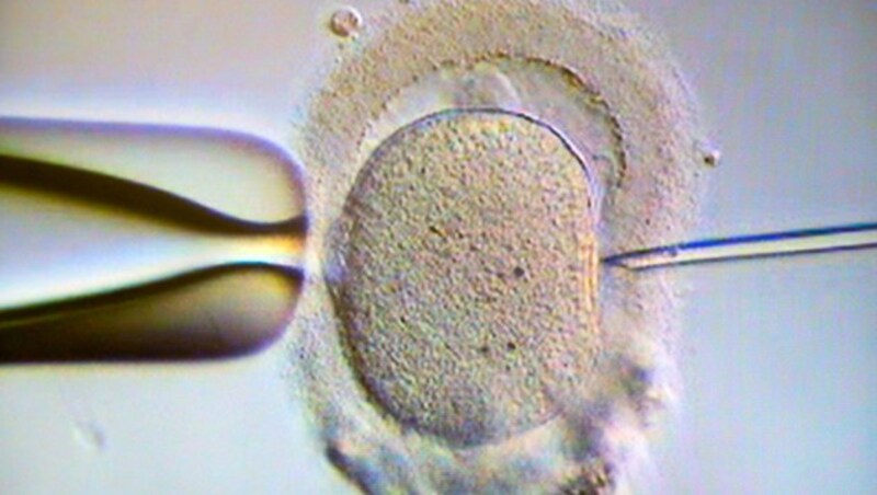 Ein Monitor zeigt eine Intrazytoplasmatische Spermien-Injektionen (ICSI) (Bild: APA)