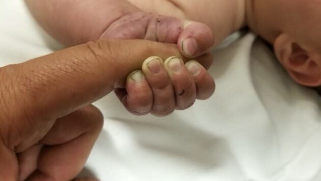 Eine berührende Aufnahme zeigt das Baby nach seiner Rettung mit Dreck unter den Fingernägeln. Ein Mann hatte es im Gebirge unter Geröll und Ästen begraben. (Bild: AP)