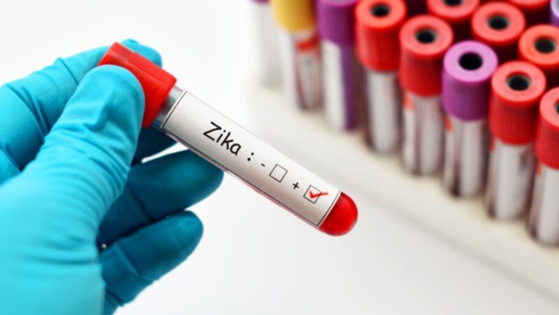 Mit einem Bluttest kann das Zika-Virus identifiziert werden. (Bild: jarun011/stock.adobe.com)