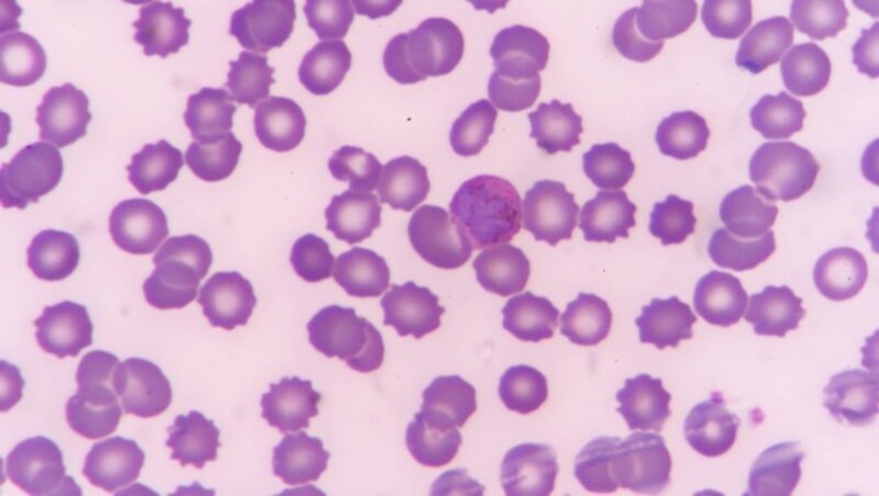 Mikroskopische Aufnahme des Malaria-Erregers Plasmodium falciparum (Bild: stock.adobe.com)