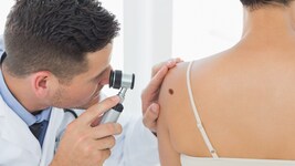 Die Gesellschaft für Dermatologie und Venerologie (ÖGDV) hat am Mittwoch einen Vorschlag zur ...