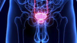 Die Prostata ist eine kleine Drüse unter der Harnblase des Mannes. (Bild: PIC4U/stock.adobe.com)