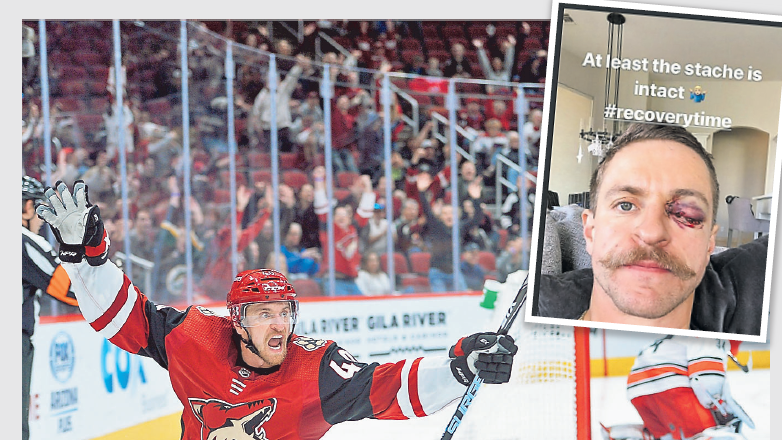 Wegen seiner argen Augenverletzung ist NHL-Star Michael Grabner seit Dezember out – eine Linse soll helfen, dass er bald wieder über Tore jubeln kann. (Bild: Joe Campreale, Instagram Grabner)