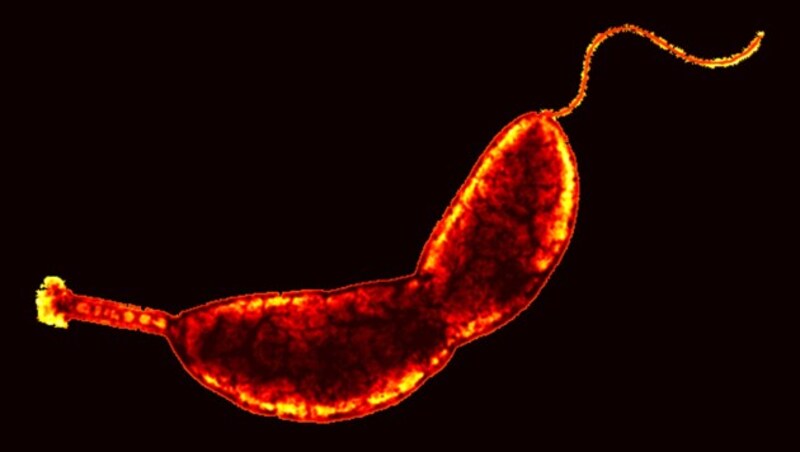 Mikroskopische Aufnahme eines Caulobacter-crescentus-Bakteriums (Bild: Wikipedia/Yves Brun)