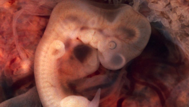 Menschlicher Embryo in der siebenten Schwangerschaftswoche (Bild: Wikipedia/Ed Uthman (gemeinfrei), Symbolbild)