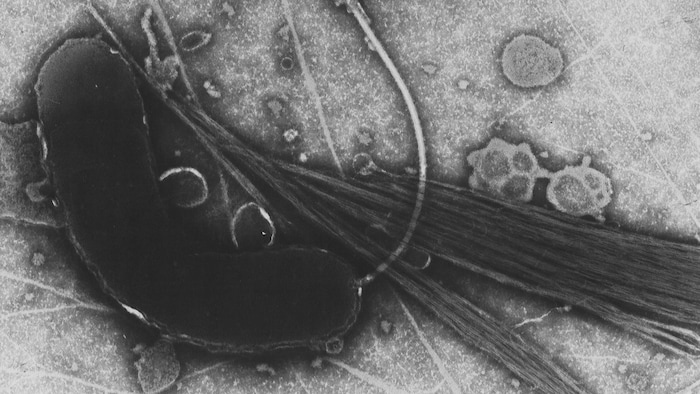 Das Bakterium Vibrio cholerae