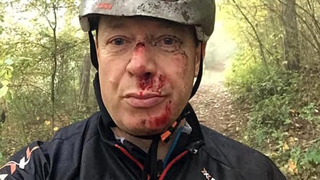 Kabarettist Alex Kristan zeigt sein blutiges Gesicht, das er sich bei einem Unfall mit dem Bike zugezogen hat. (Bild: facebook.com/AlexKristan.official)