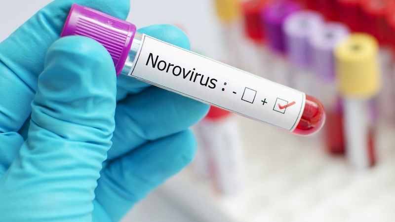 Norovirüs (sembolik resim) (Bild: stock.adobe.com)