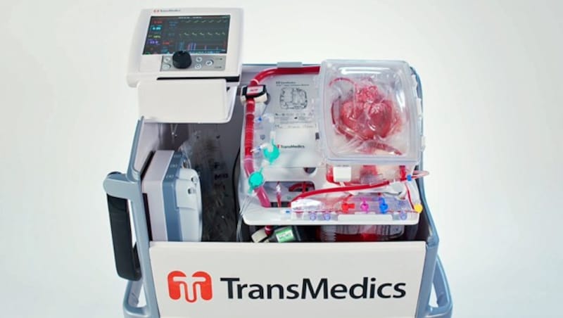 So ein Gerät des US-Unternehmens TransMedics wurde bei der Transplantation verwendet. (Bild: transmedics.com)