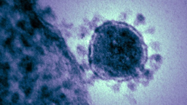 Elektronemikroskopische Aufnahme eines Coronavirus (Bild: NIAID)