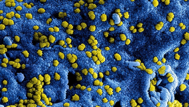 Elektronenmikroskopische und eingefärbte Aufnahme von Coronaviren (gelb) (Bild: NIAID)