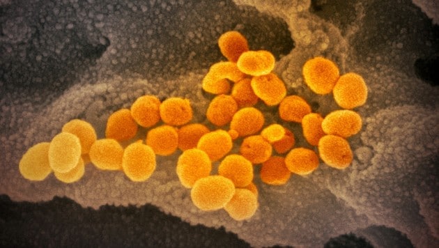 Elektronenmikroskopische Aufnahme von Coronaviren des Typs SARS-CoV-2 (gelb) (Bild: NIAID-RML)