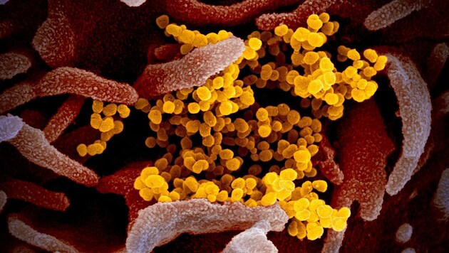 Elektronenmikroskopische Aufnahme des Coronavirus SARS-CoV2 (gelb) (Bild: NIAID-RML)