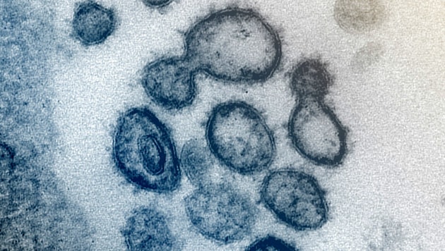 Elektronenmikroskopische Aufnahme des Erregers SARS-CoV-2 (Bild: NIAID)