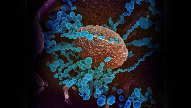 Elektronenmikroskopische Aufnahme des Coronavirus SARS-CoV-2 (hellblau) (Bild: NIAID-RML)