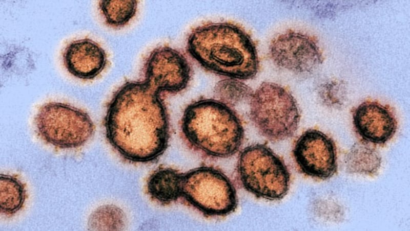 Elektronenmikroskopische Aufnahme des Coronavirus SARS-CoV-2 (braun) (Bild: NIAID-RML)