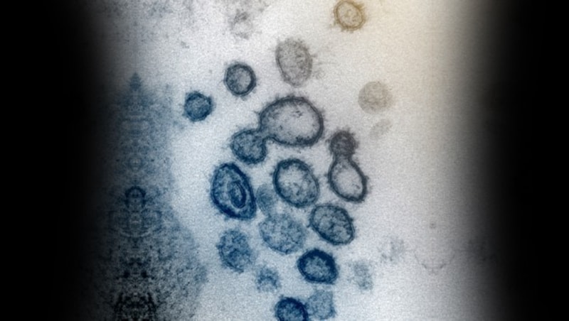 Elektronenmikroskopische Aufnahme des Coronavirus SARS-CoV-2 (blau) (Bild: NIAID-RML)