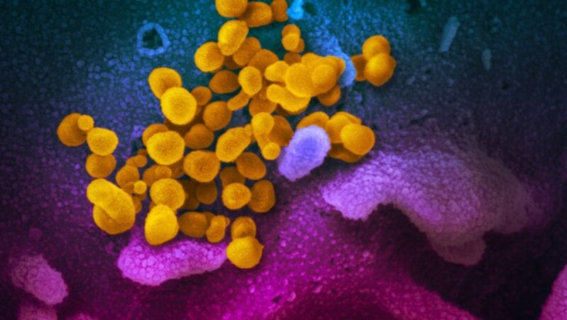 Elektronenmikroskopische Aufnahme des Coronavirus SARS-CoV-2 (gelb) (Bild: NIAID-RML)