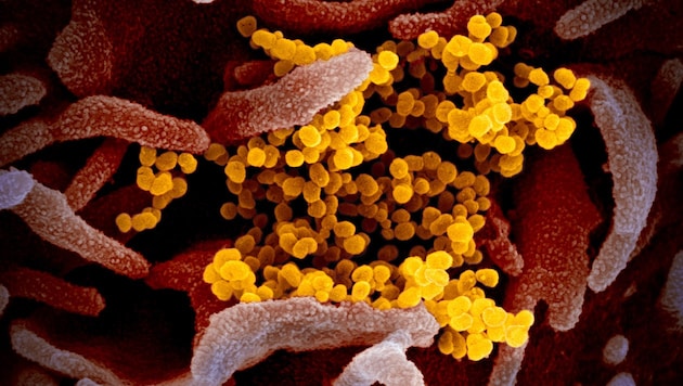 Elektronenmikroskopische Aufnahme des Coronavirus SARS-CoV-2 (gelb) (Bild: NIAID-RML)