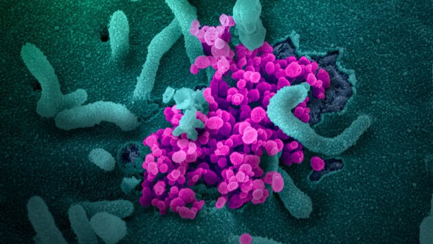Elektronenmikroskopische Aufnahme des Coronavirus SARS-CoV-2 (rosa) (Bild: NIAID-RML)