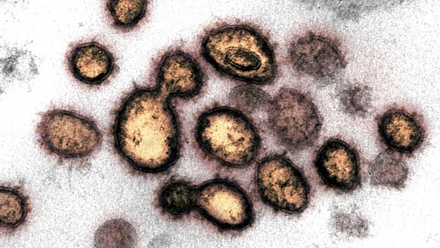 Elektronenmikroskopische Aufnahme des Coronavirus SARS-CoV-2 (hellgelb) (Bild: NIAID-RML)