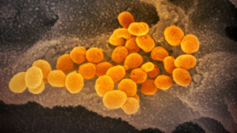 Elektronenmikroskopische Aufnahme des Coronavirus SARS-CoV-2 (gelb) (Bild: NIAID-RML)