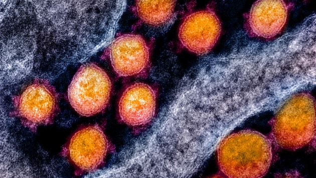 Elektronenmikroskopische Aufnahme des Coronavirus SARS-CoV-2 (orange) (Bild: NIAID-RML)
