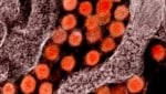 Elektronenmikroskopische Aufnahme des Coronavirus SARS-CoV-2 (rot) (Bild: NIAID-RML)