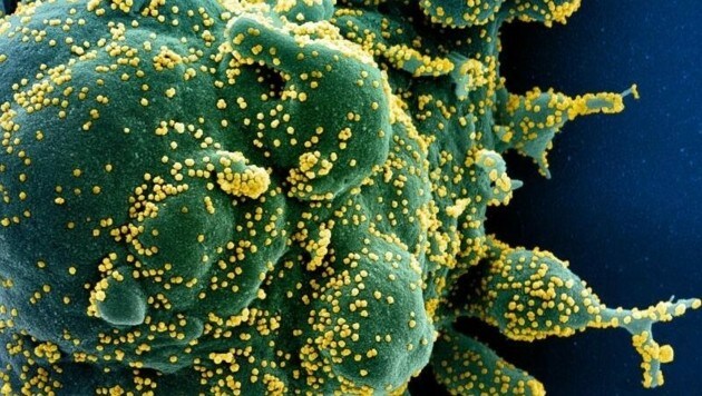 Wiener Forscher haben eine bis dato noch unbekannte Schwachstelle des Erregers SARS-CoV-2 (im Bild gelb) entdeckt. (Bild: NIAID-RML)