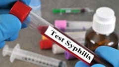 Die ÖH und AIDS-Hilfen bieten zum zweiten Mal kostenlose Tests auf sexuell übertragbare ...