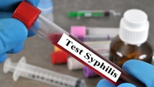 Die ÖH und AIDS-Hilfen bieten zum zweiten Mal kostenlose Tests auf sexuell übertragbare ...