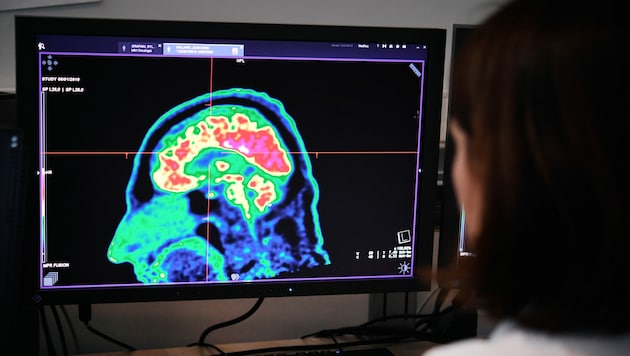 Positronenemissionstomographie eines Gehirns (Bild: APA/AFP/Fred TANNEAU)