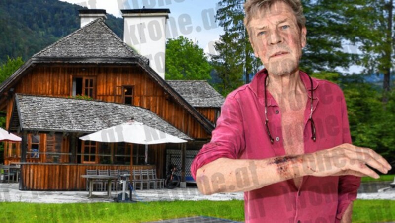 In diesem Jagdhaus im idyllischen Grünau kam es vergangenen Mittwoch zu den wüsten Szenen. Beim Besuch der „Krone“ zeigte Ernst August seine Verletzungen an Hand, Gesicht, Brust und Ellbogen. (Bild: Klemens Fellner, krone.at-Grafik)