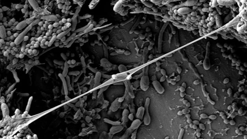 Rasterelektronenmikroskopische Aufnahme eines Mischkultur-Biofilms (Bild: Wikipedia/Krzysztof A. Zacharski (CC-BY 4.0))