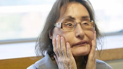 Connie Culp (hier auf einer Aufnahme aus dem Jahr 2010) starb im Alter von 57 Jahren. Sie war weltweit die erste Patientin, der ein neues Gesicht transplantiert worden war. (Bild: AP)