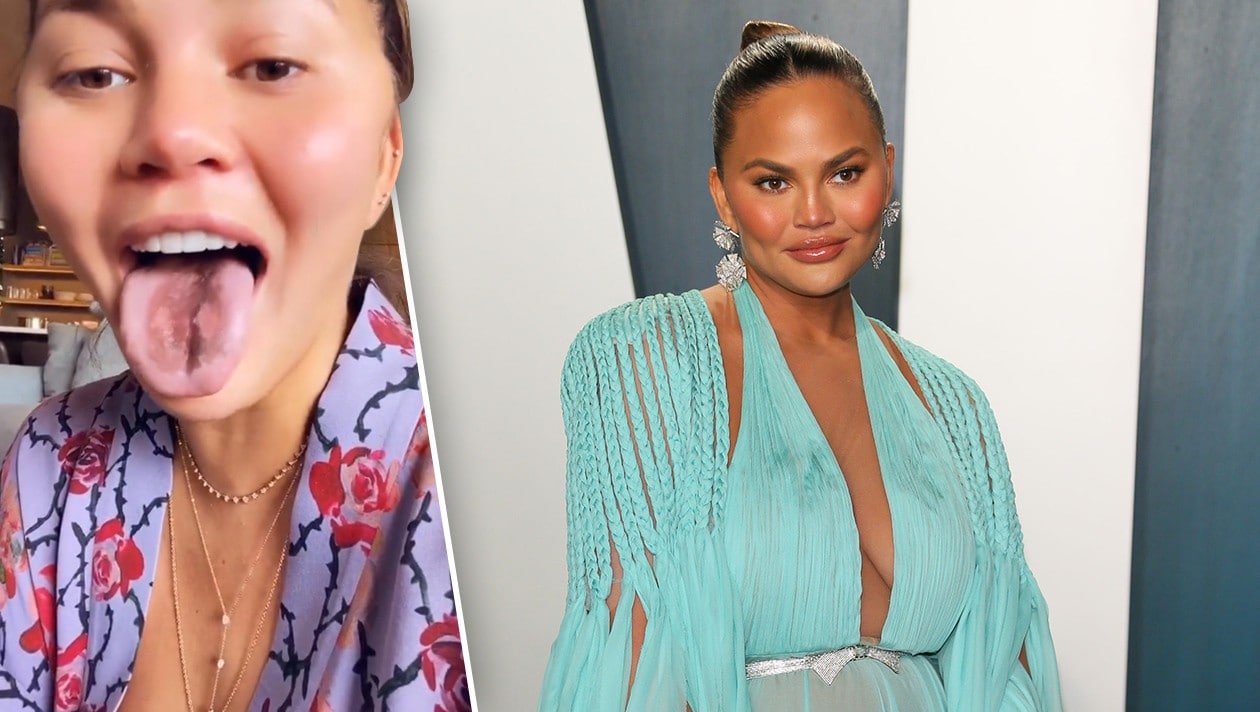 Irre Nasch Geluste Schwangere Chrissy Teigen Meine Zunge Fallt Ab Krone At