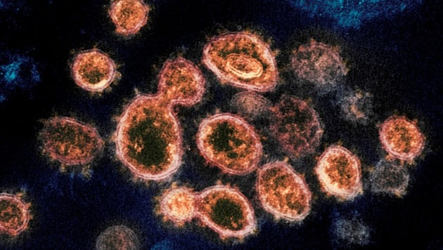 Laut einer Studie kann das Coronavirus bis zu 28 Tage auf Oberflächen überleben. (Bild: AP)