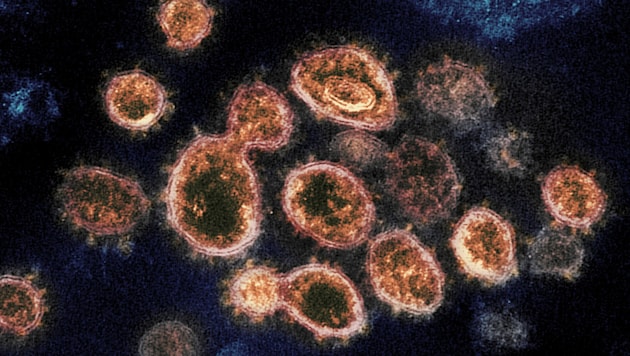 Laut einer Studie kann das Coronavirus bis zu 28 Tage auf Oberflächen überleben. (Bild: AP)