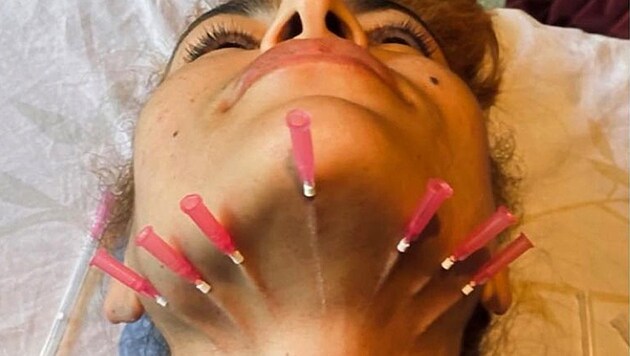 Eva Mendes schockt ihre Fans mit einem Foto ihrer Beauty-Behandlung. (Bild: instagram.com/evamendes)
