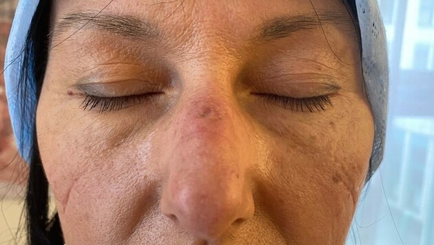 Ein Covid-19-Pflegedienst hinterlässt auch Druckstellen im Gesicht (Bild: ZVG)