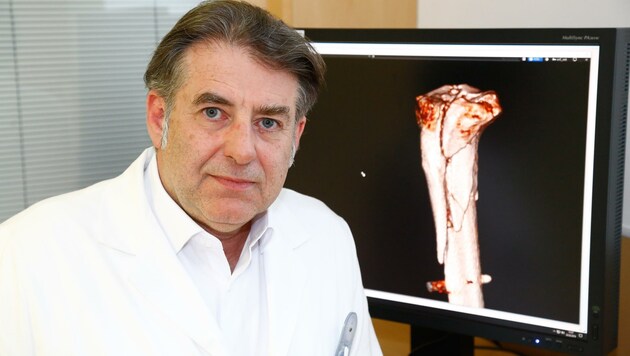 Manfred Mittermair leitet die Unfallchirurgie im Klinikum Schwarzach. (Bild: Gerhard Schiel)