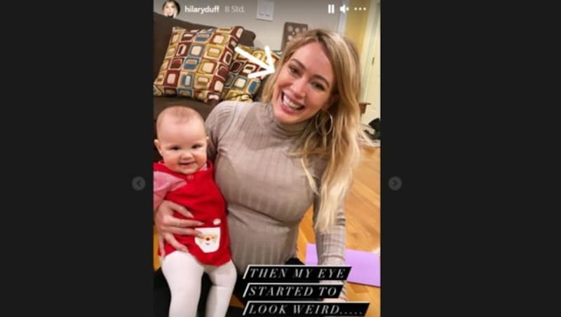 Hilary Duff schildert in ihrer Instagram-Story, dass sie von den zahlreichen Corona-Tests am Set ihrer Serie „Younger“ eine Augenentzündung bekommen habe. (Bild: instagram.com/hilaryduff)