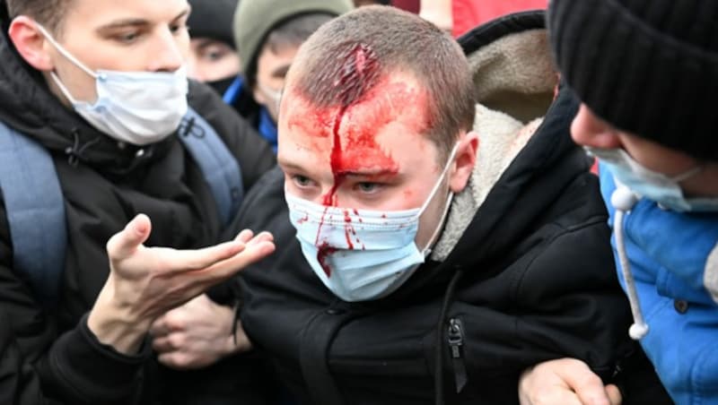 Demonstranten wurden bei den Protesten verletzt. (Bild: AFP)