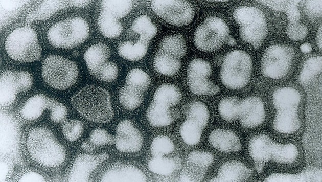 Electron microscope images of bird flu viruses (Bild: CDC/Erskine Palmer)